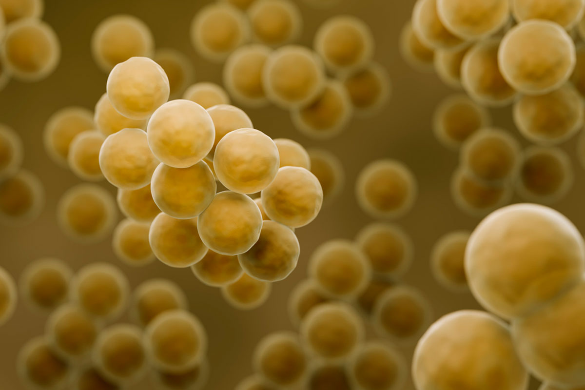 What is Toxic Shock Syndrome, and how can it be prevented?